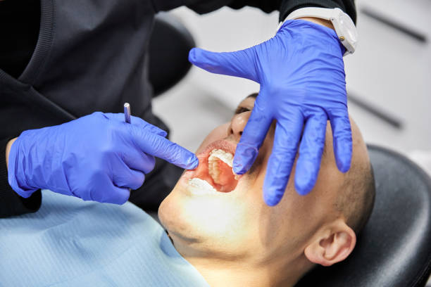 Best Emergency Denture Repair in Tonawanda, NY
